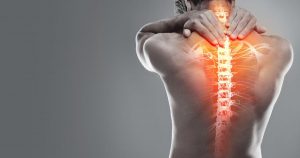 a man's back with spinal inflammation caused by lupus myelitis
